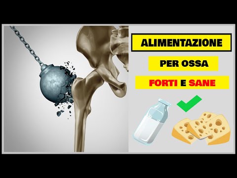 Come sbarazzarsi del dolore al collo, se la tirò Giunti tavola con linnervazione e sangue