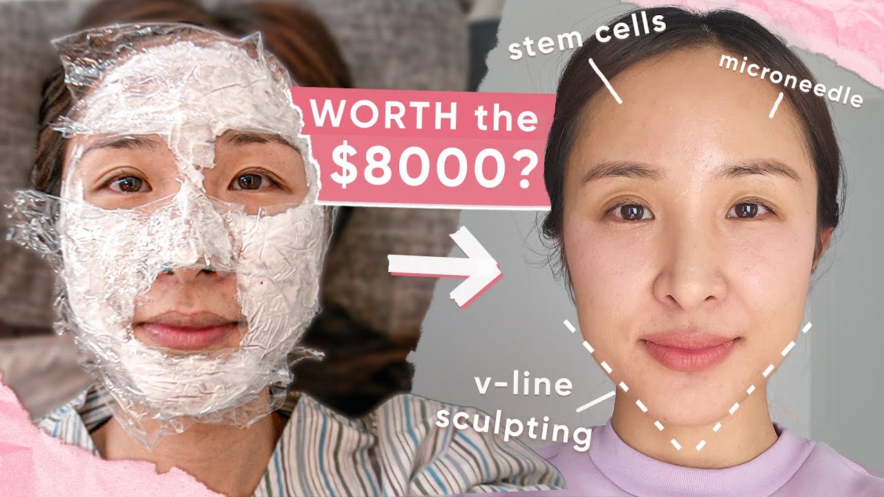 I tried $8000 SKIN TREATMENTS in KOREA! 👀 *I’ve got thoughts...*