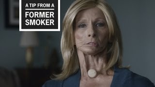 CDC: Tips From Former Smokers - Terrie's Voice Tip Ad