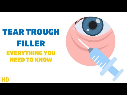 All About Allergy Shots