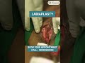 Labiaplasty Surgery Vagina Tighten Plastic Surgery At Elegance Clinic In Vesu Surat