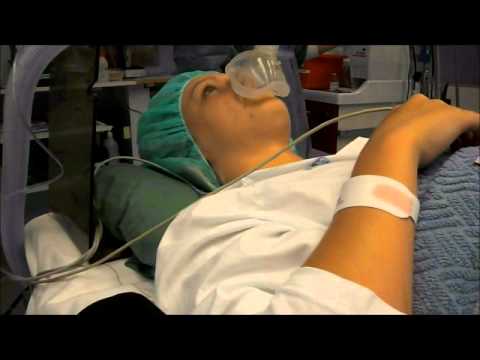 Korsbandsoperation, sövning