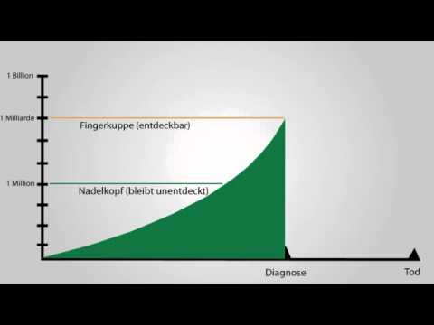 Prognose von Prostatakrebs Stufe 4 Vitaprost und vitaprost forte ist die Differenz Bewertungen