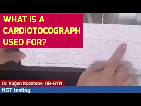 NST (non-stress) testing at 31st week because of contractions. What do probes on your belly detect?