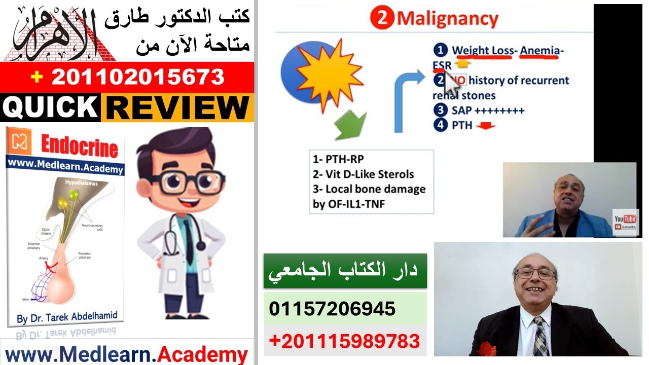 Hypercalcemia (Quick Review) #cme #internal_medicine #usmle #medicalstudent #محاضرات_باطنة