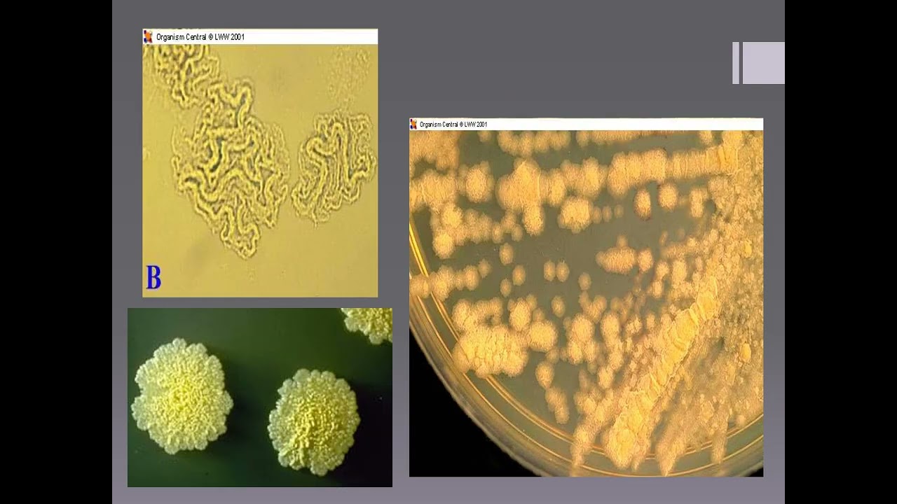 Unit 9, Mycobacteriology Narrated