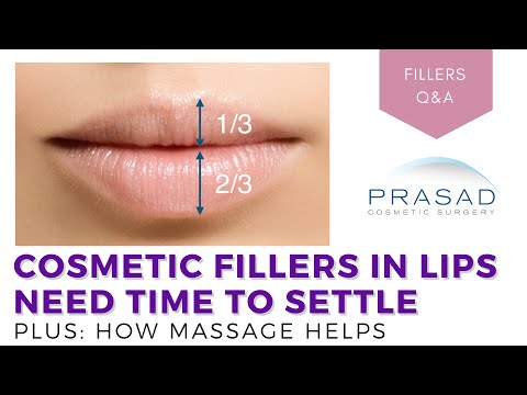 YouTube video about: Does filler take time to settle?