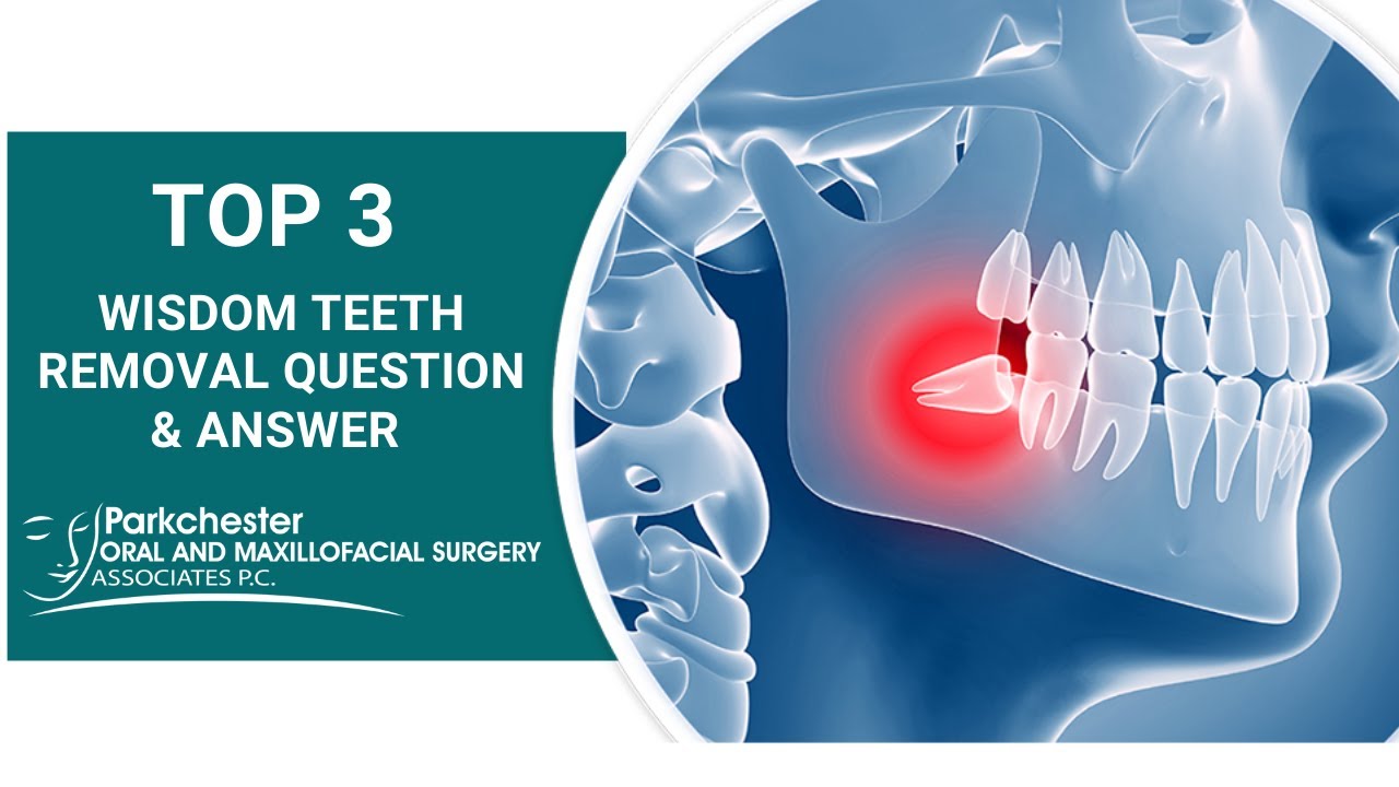Top 3 Wisdom Teeth Removal Questions to Ask!