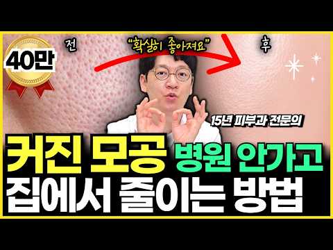 "병원 안가도 됩니다" 집에서 모공 쉽게 줄이는 방법을 서울대 피부과 전문의가 알려드립니다.