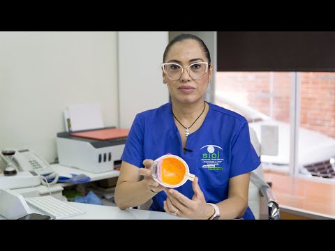 ¿Qué partes del ojo afecta la diabetes?
