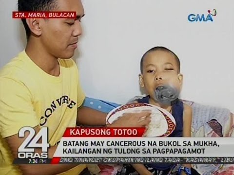 Slimming mula coke Kung ano ang hormones na kailangan upang pumasa sa labis na timbang