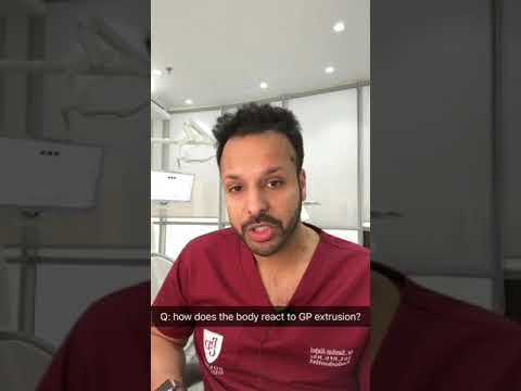 Extrusion of gutta-percha beyond the apex in Endodontic treatment