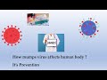 MUMPS- How mumps virus affects human body & it's prevention.