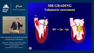 Valve Repair at the Sixth Decade: Challanges Continue