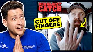 Doctor Reacts To Deadliest Catch Injuries