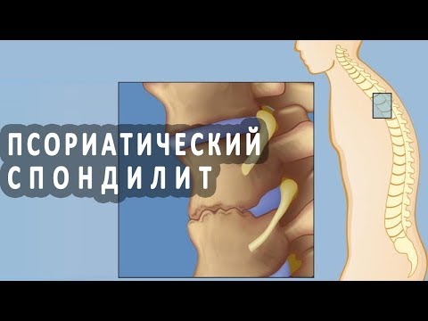 Болит ниже пояснице слева Боль в пояснице и набухание груди