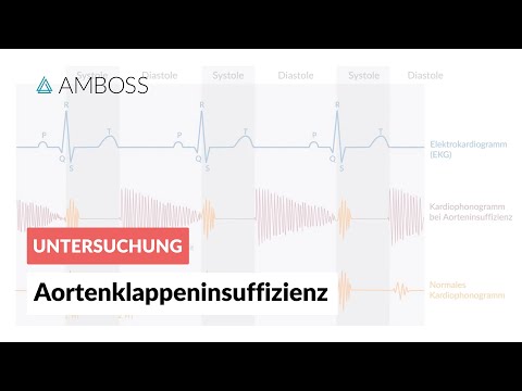 Medikamente, die für Hypertonie nicht getroffen werden können Die Rate des Blutdruckes bei einem Kind