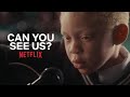 BAADA YA KUZALIWA AKAKATALIWA NA BABA YAKE SABABU NI ALBINO CAN YOU SEE US 2022