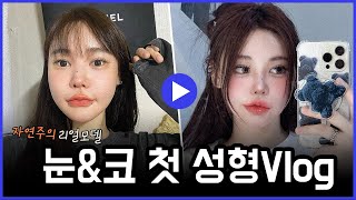 자연주의 성형외과 리얼모델 눈&코 첫성형vlog