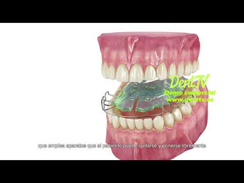 DentTV presenta: La ortodoncia