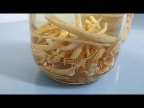 Áscaris (lombriga) e Tênia (solitária)