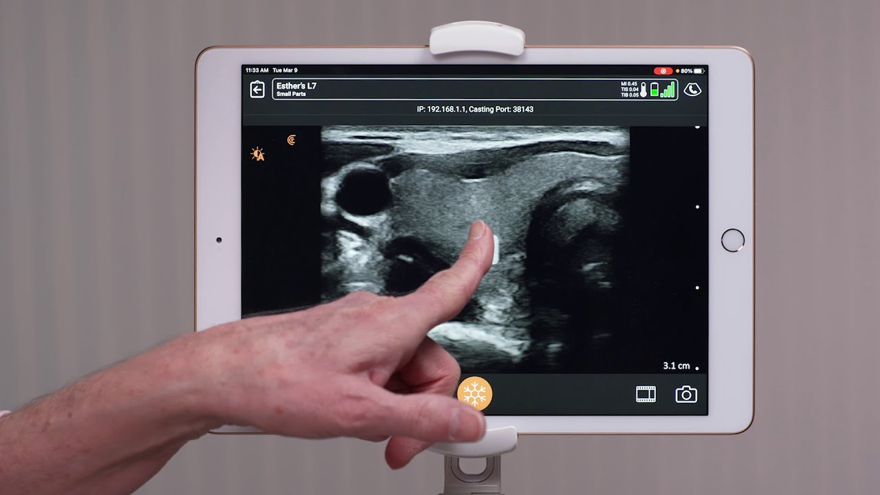 Clarius Feature: Adjusting Gain