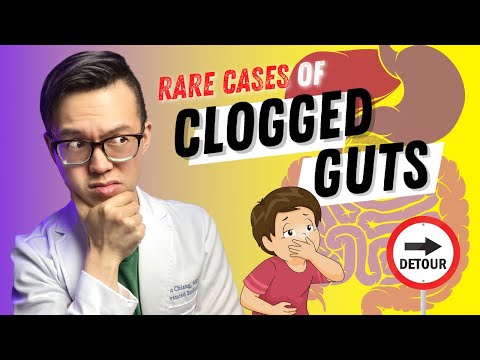 Nausea and vomiting from BLOCKED INTESTINE | Gut Health