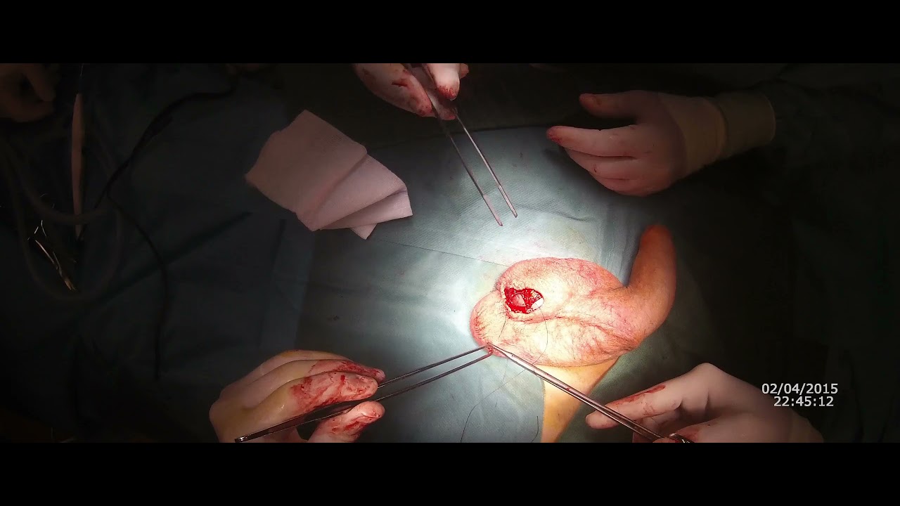 Pier Andrea Della Camera-85