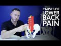 Low Back Pain The Most Common Causes Of Lower Back Pain