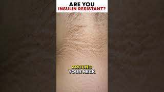 Are you Insulin Resistant? | SugarMD [Sugarmds.com]