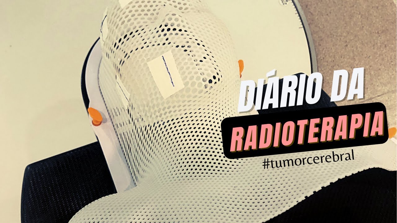 DIÁRIO DA RADIOTERAPIA - Tumor Cerebral