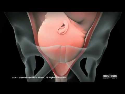 Ernia intervertebrale dei sintomi colonna vertebrale toracica La storia medica del polso contusione