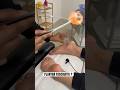 FIRE CUPPING ON THE FEET Asmr Sydney Chiropractic Massage Shorts