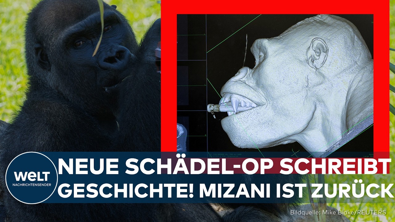MEDIZINISCHE SENSATION: 140 Kilo schwer und schwer krank – Mediziner retten Mizani in letzter Minute