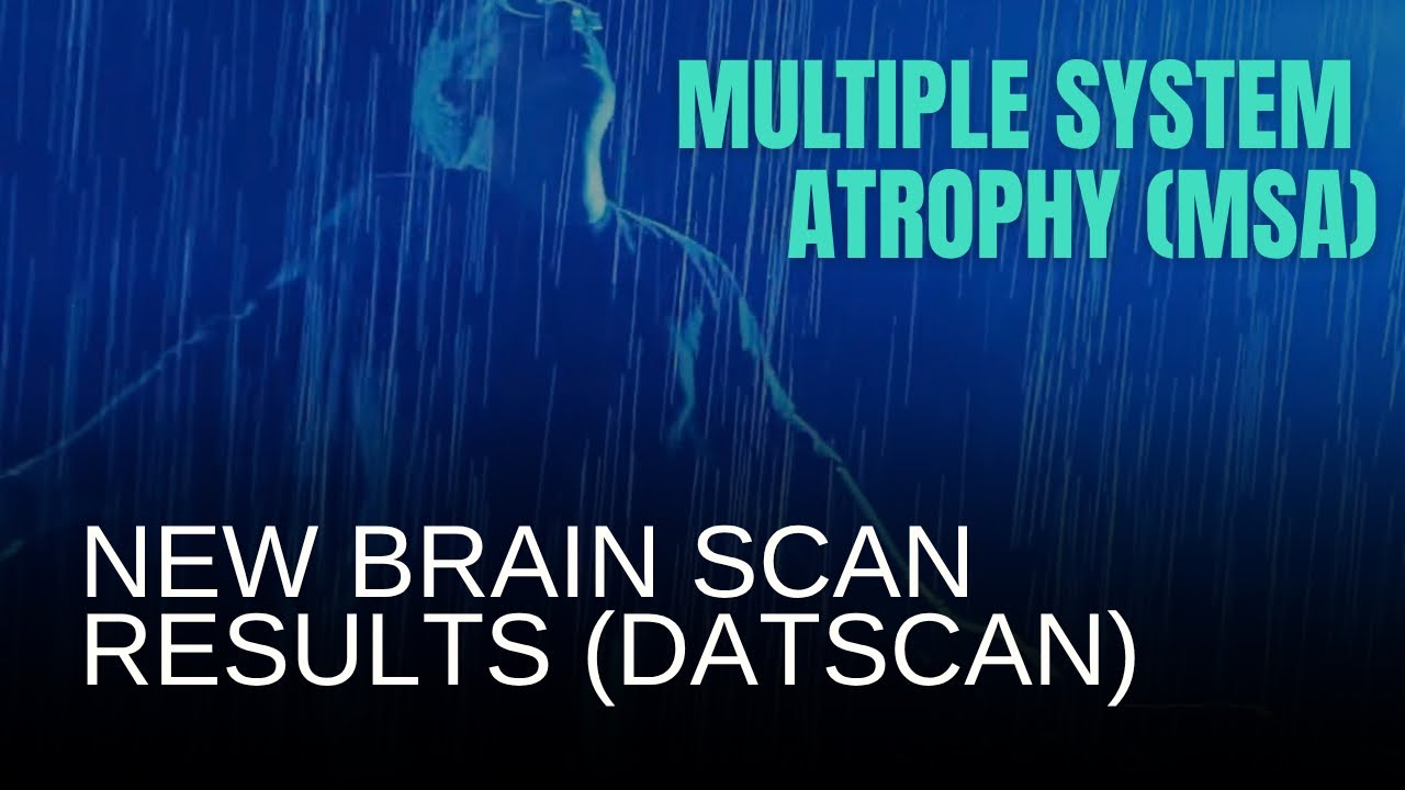 The Truth About My New DaTscan results | MSA (Multiple System Atrophy) 