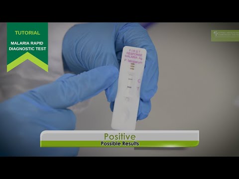 How to use a Malaria Rapid Diagnostic Test