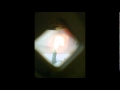 M.Ward -  He Asked Me to Be a Snake & Live