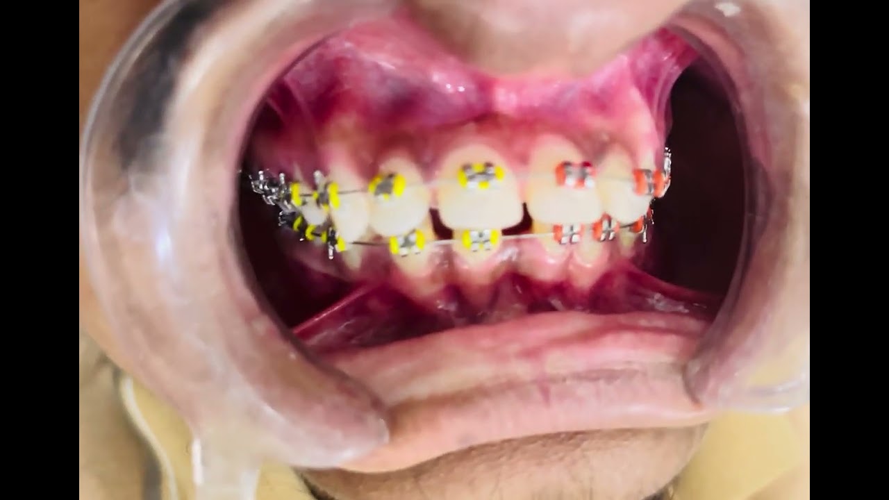 আশ্রম থেকে সুন্দর হাসির অপেক্ষায় ছিলাম, এখন তা সত্যি হলো। - Video Review