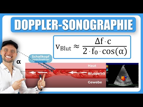 Doppler sonography (blood flow velocity)