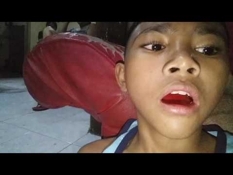 Murang analogue ekzoderil Kung aalisin mo ang kuko halamang-singaw ay magdadala