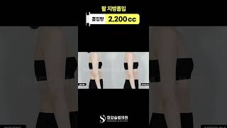 긴팔 속에 숨어도 티 나는 뼈팔