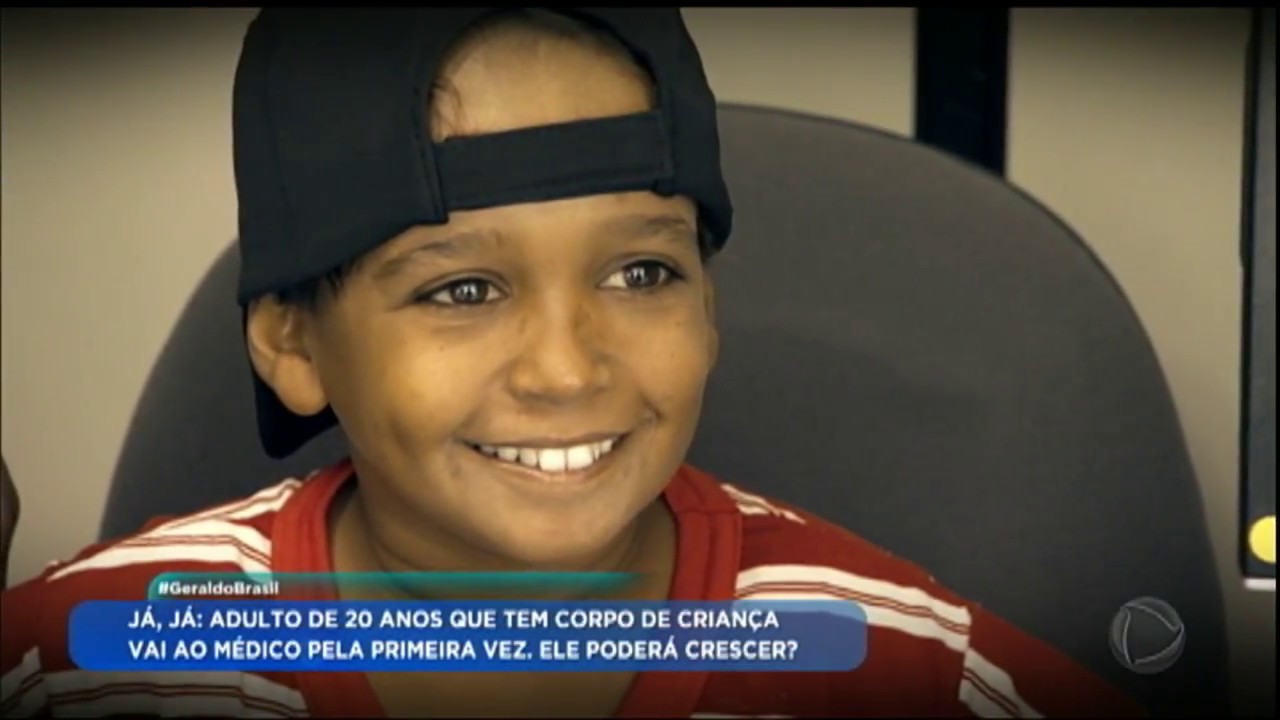 Geraldo Luís mostra o drama de Fabrício, o adulto de 20 anos que tem corpo de criança