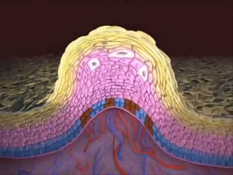 papilloma vírus hány hívás