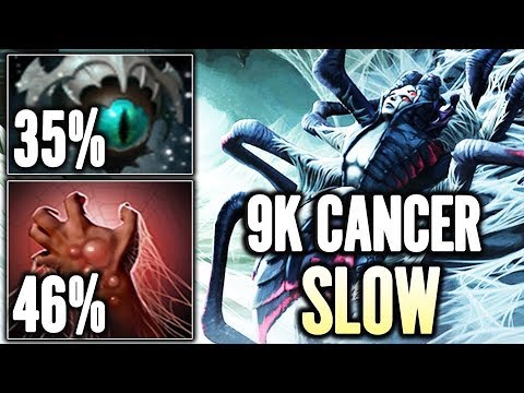 Cancer Slow Build with Skadii Broodmother by Matumbaman Dota 2