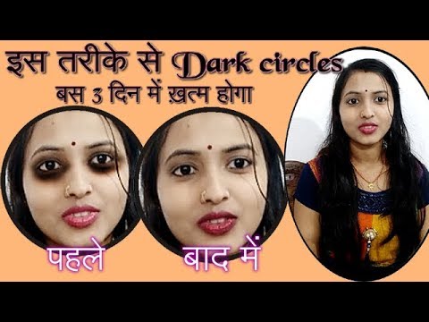 Dark Circles Under Eyes Home Remedy || How to remove Dark circles Naturally in 3 days Video