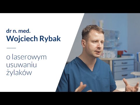 Od czego zależy cena laserowego usuwania żylaków?