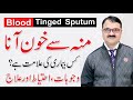 Blood Tinged Sputum Moun Se Khoon Ana Khoon Thukna Causes By Dr Tariq Ali Sheikh