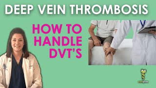 Deep Vein Thrombosis (How to handle DVT