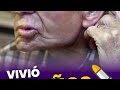 94 Años Con Una BALA En La CABEZA