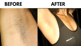 How I shave my armpits without causing bumps and ingrown hairs